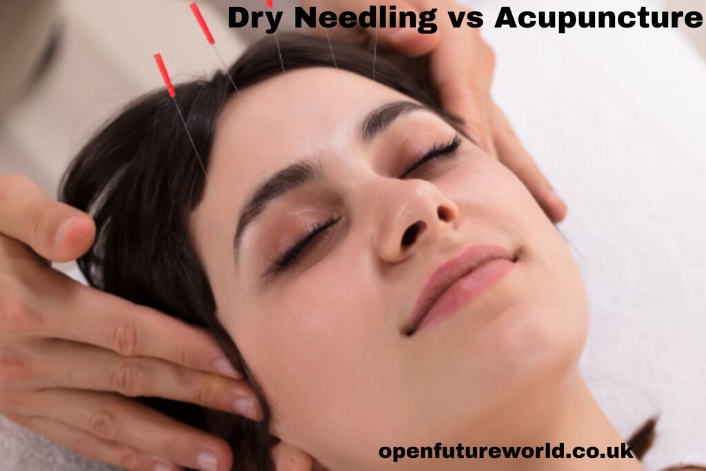 Dry Needling vs Acupuncture