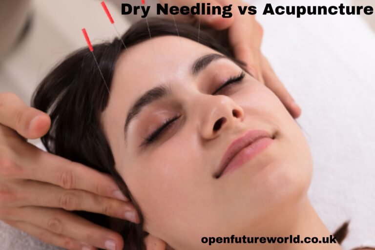 Dry Needling vs Acupuncture