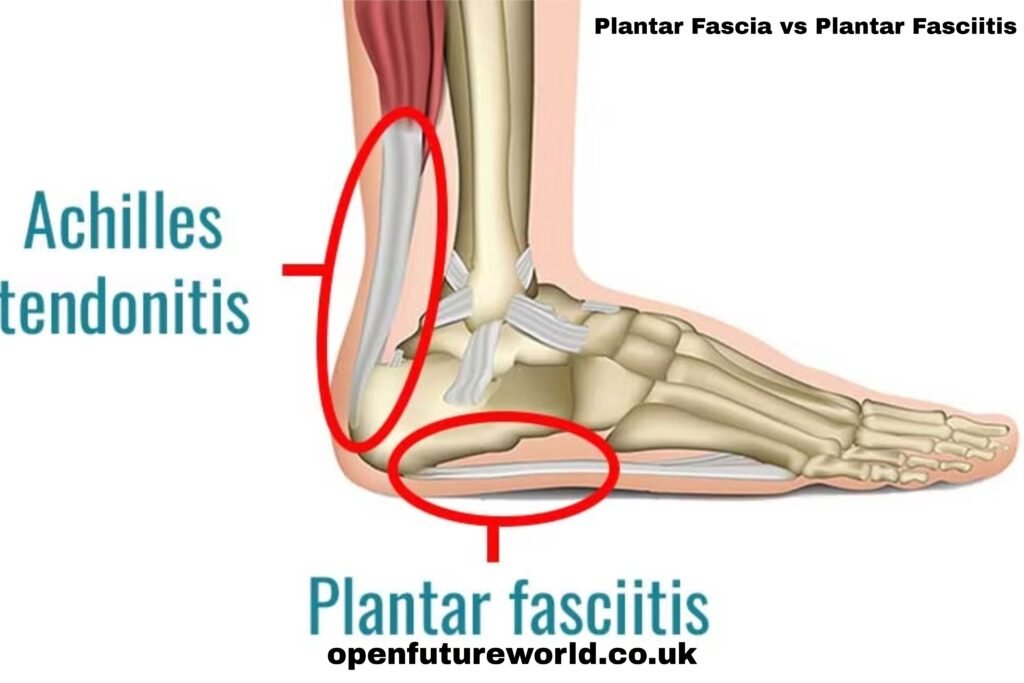 Plantar Fascia vs Plantar Fasciitis