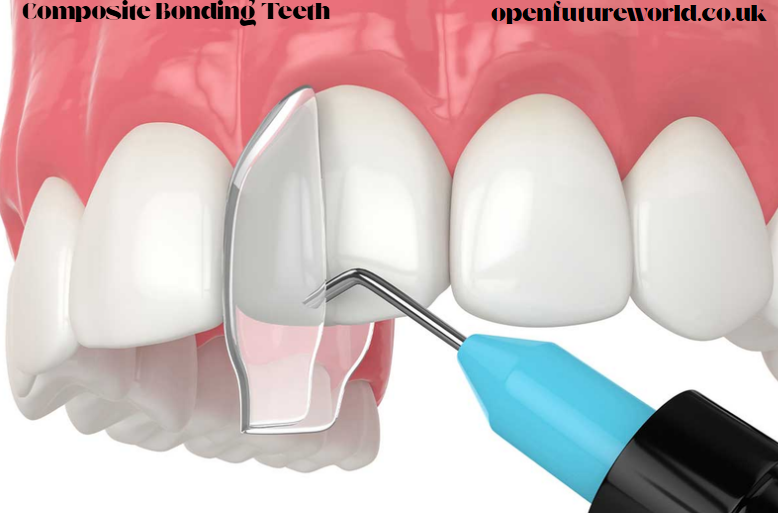Composite Bonding Teeth