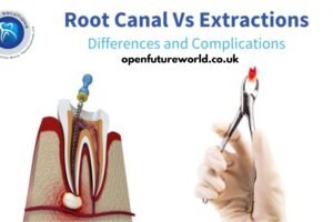 Root Canal vs Extraction